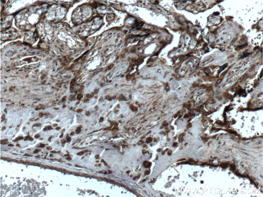 Immunohistochemistry (IHC) staining of human placenta tissue using FGF3-Specific Polyclonal antibody (16874-1-AP)