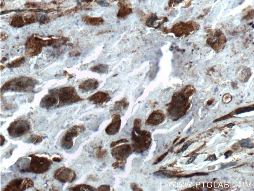 Immunohistochemistry (IHC) staining of human placenta tissue using FGF3-Specific Polyclonal antibody (16874-1-AP)