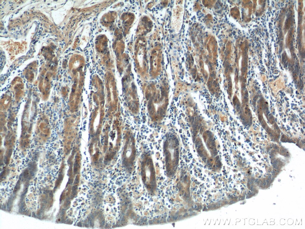 Immunohistochemistry (IHC) staining of human stomach tissue using FGF5 Polyclonal antibody (18171-1-AP)