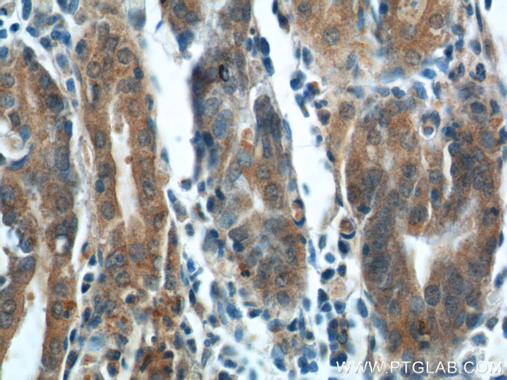 Immunohistochemistry (IHC) staining of human stomach tissue using FGF5 Polyclonal antibody (18171-1-AP)