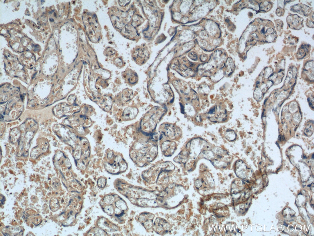 Immunohistochemistry (IHC) staining of human placenta tissue using FGF5 Polyclonal antibody (18171-1-AP)