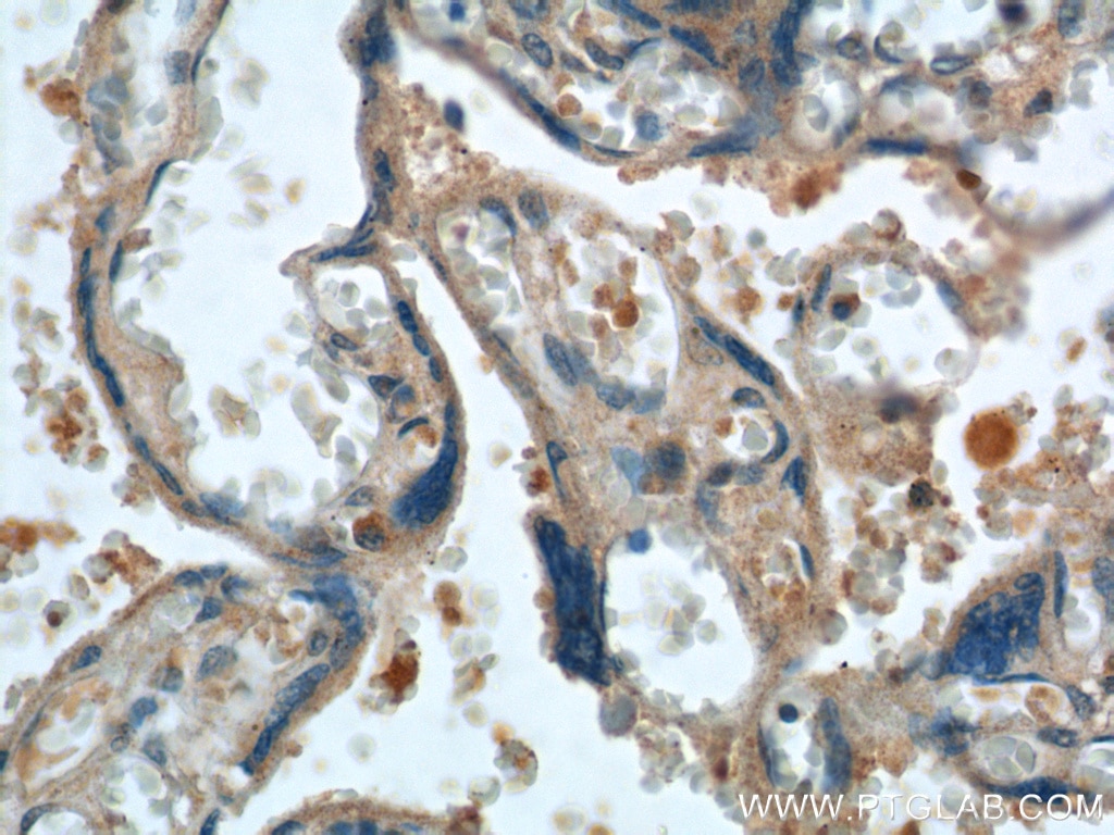 Immunohistochemistry (IHC) staining of human placenta tissue using FGF5 Polyclonal antibody (18171-1-AP)