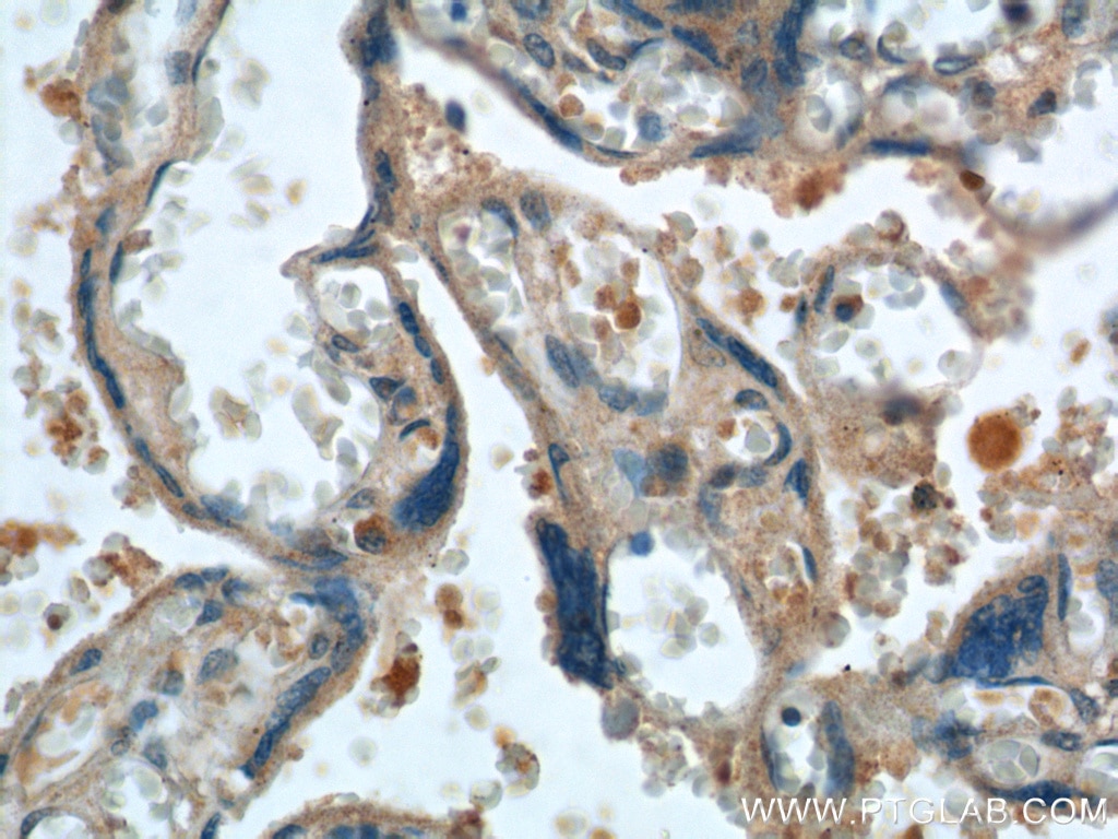 IHC staining of human placenta using 18171-1-AP