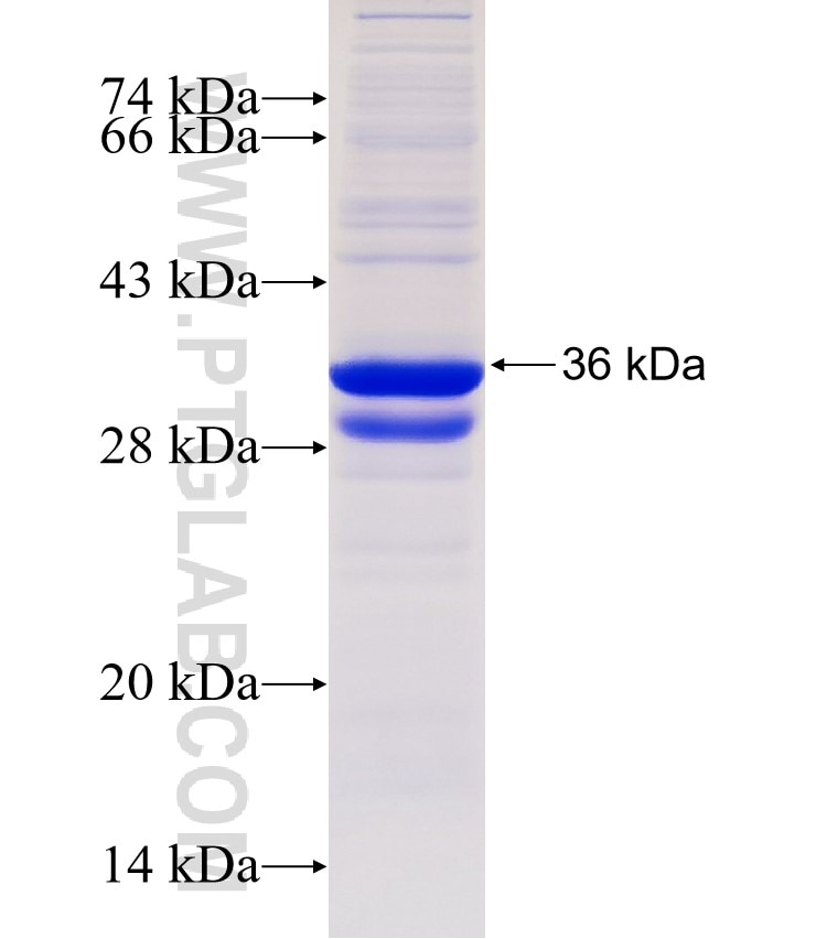 FGF5 fusion protein Ag31721 SDS-PAGE FGF5 fusion protein Ag31721 SDS-PAGE