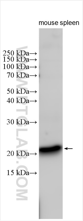 Western Blot (WB) analysis of various lysates using FGF7 Polyclonal antibody (10939-1-AP)