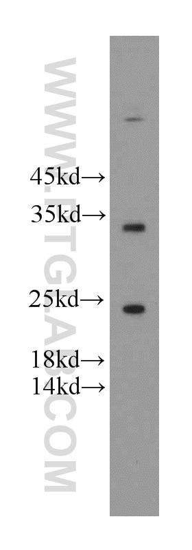 Western Blot (WB) analysis of HeLa cells using FGF8 Polyclonal antibody (20711-1-AP)