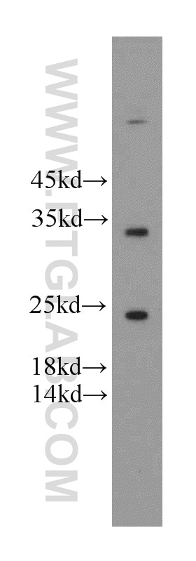 WB analysis of HeLa using 20711-1-AP