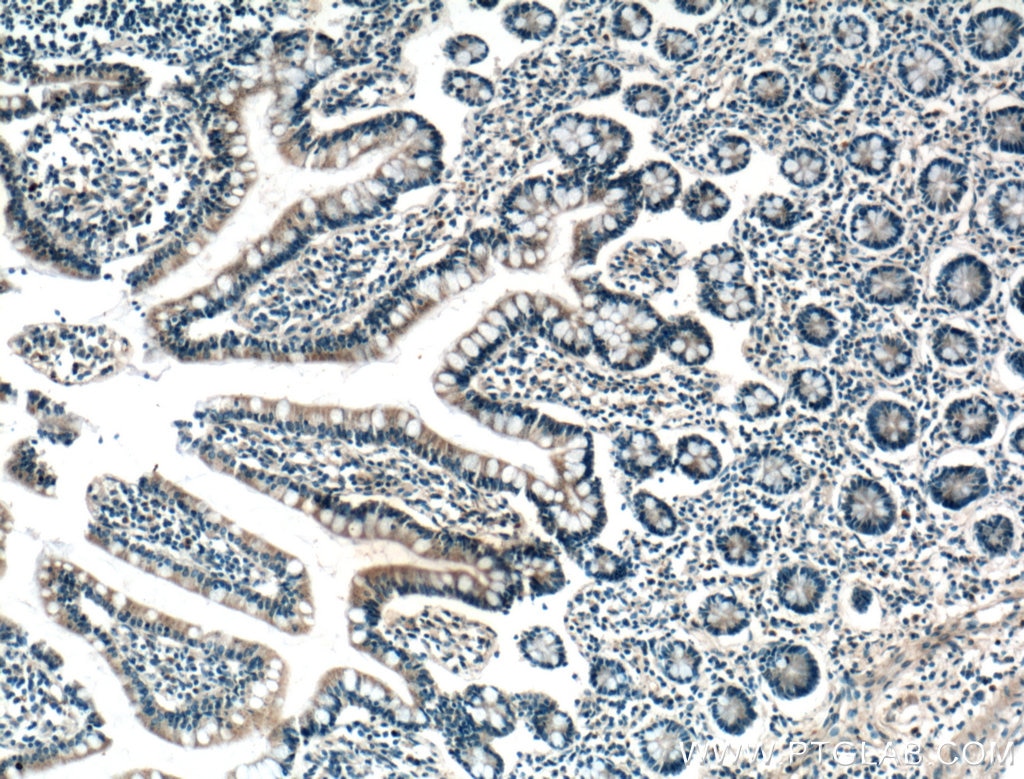 Immunohistochemistry (IHC) staining of human small intestine tissue using FGF9 Polyclonal antibody (26554-1-AP)