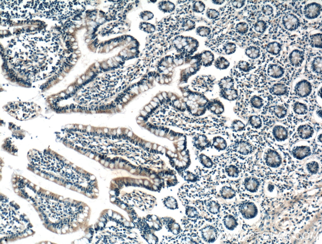 IHC staining of human small intestine using 26554-1-AP