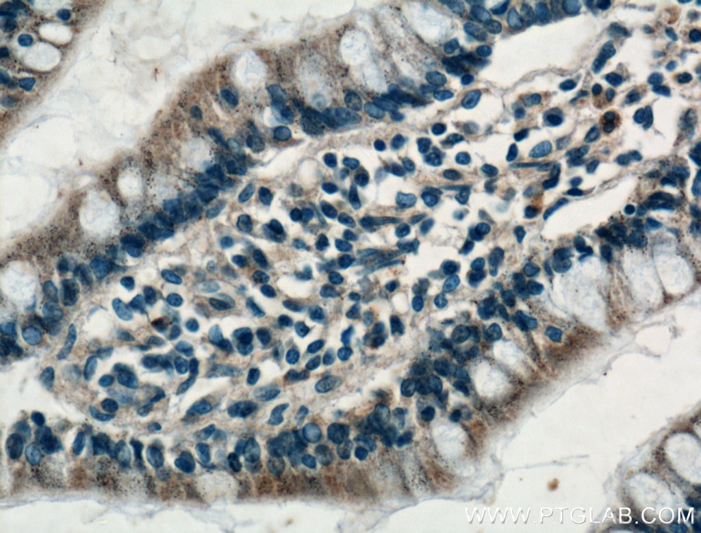 Immunohistochemistry (IHC) staining of human small intestine tissue using FGF9 Polyclonal antibody (26554-1-AP)