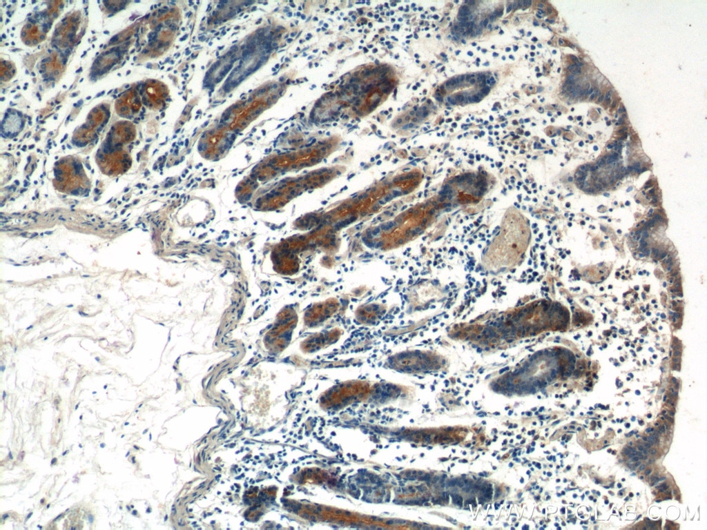 Immunohistochemistry (IHC) staining of human stomach tissue using FGF9 Polyclonal antibody (26554-1-AP)