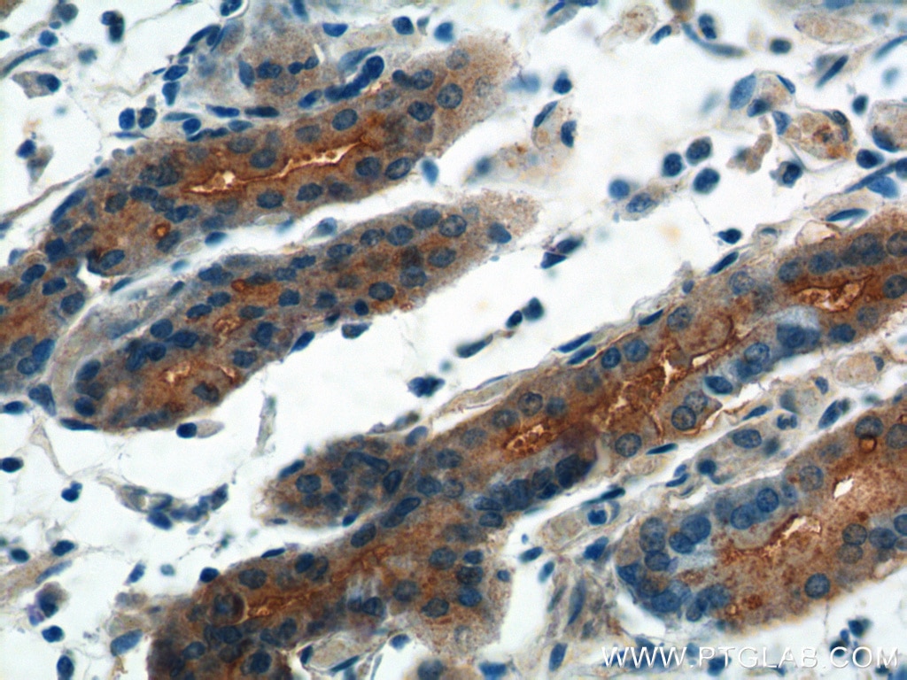 Immunohistochemistry (IHC) staining of human stomach tissue using FGF9 Polyclonal antibody (26554-1-AP)
