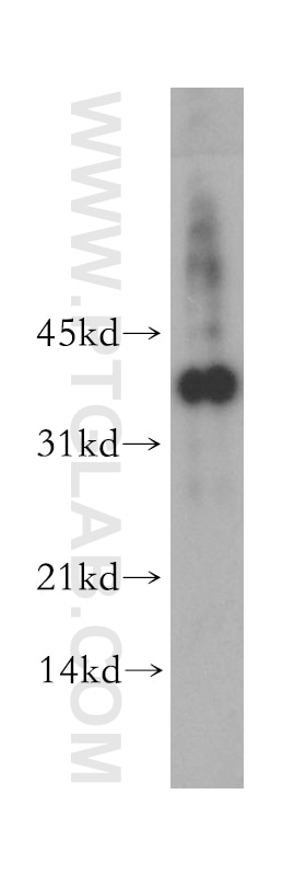Western Blot (WB) analysis of BxPC-3 cells using FGFBP2 Polyclonal antibody (13254-1-AP)