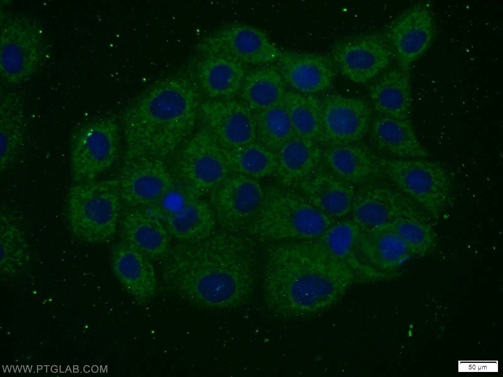Immunofluorescence (IF) / fluorescent staining of A431 cells using FGFBP3 Polyclonal antibody (24725-1-AP)
