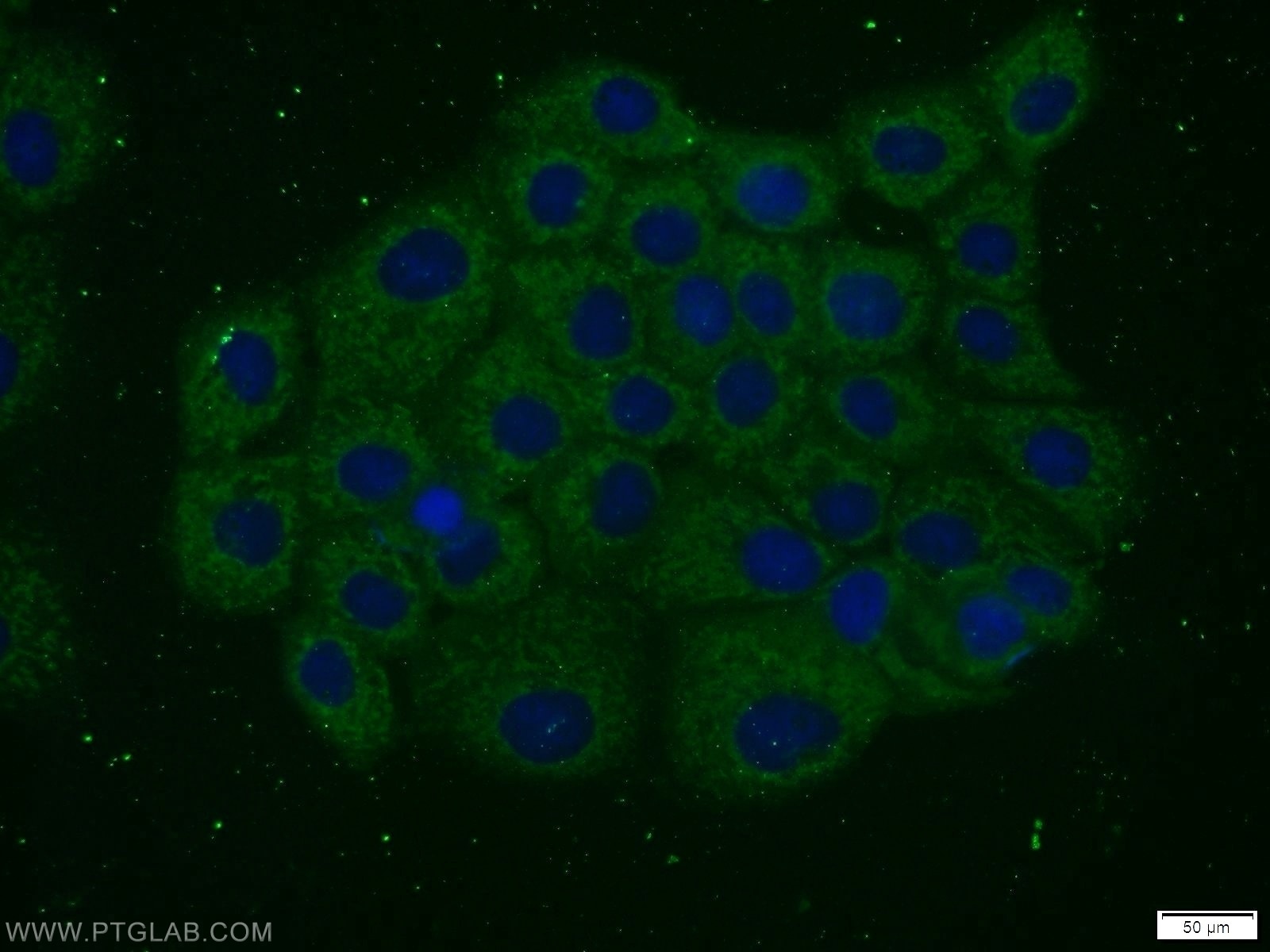 IF Staining of A431 using 24725-1-AP