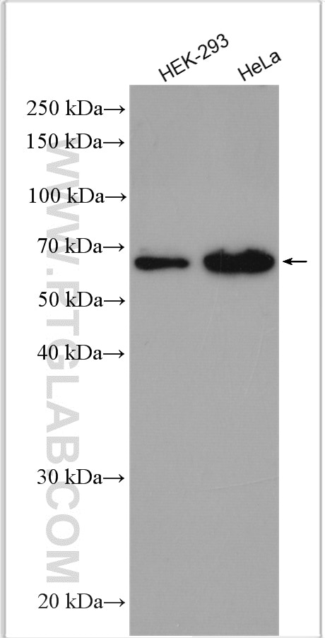 Western Blot (WB) analysis of various lysates using FGFBP3 Polyclonal antibody (24725-1-AP)