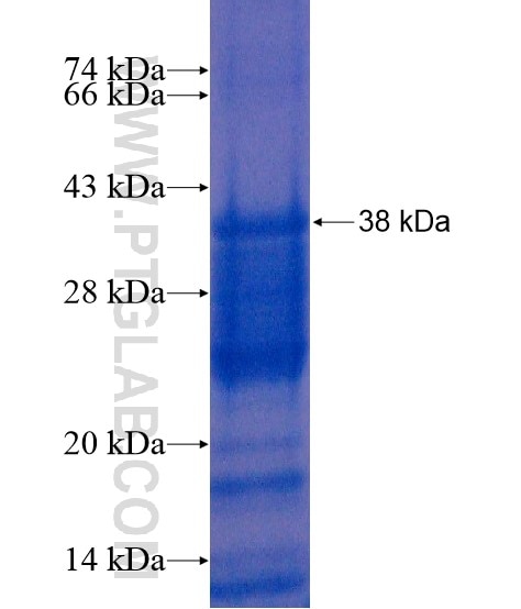 FGFBP3 fusion protein Ag20573 SDS-PAGE