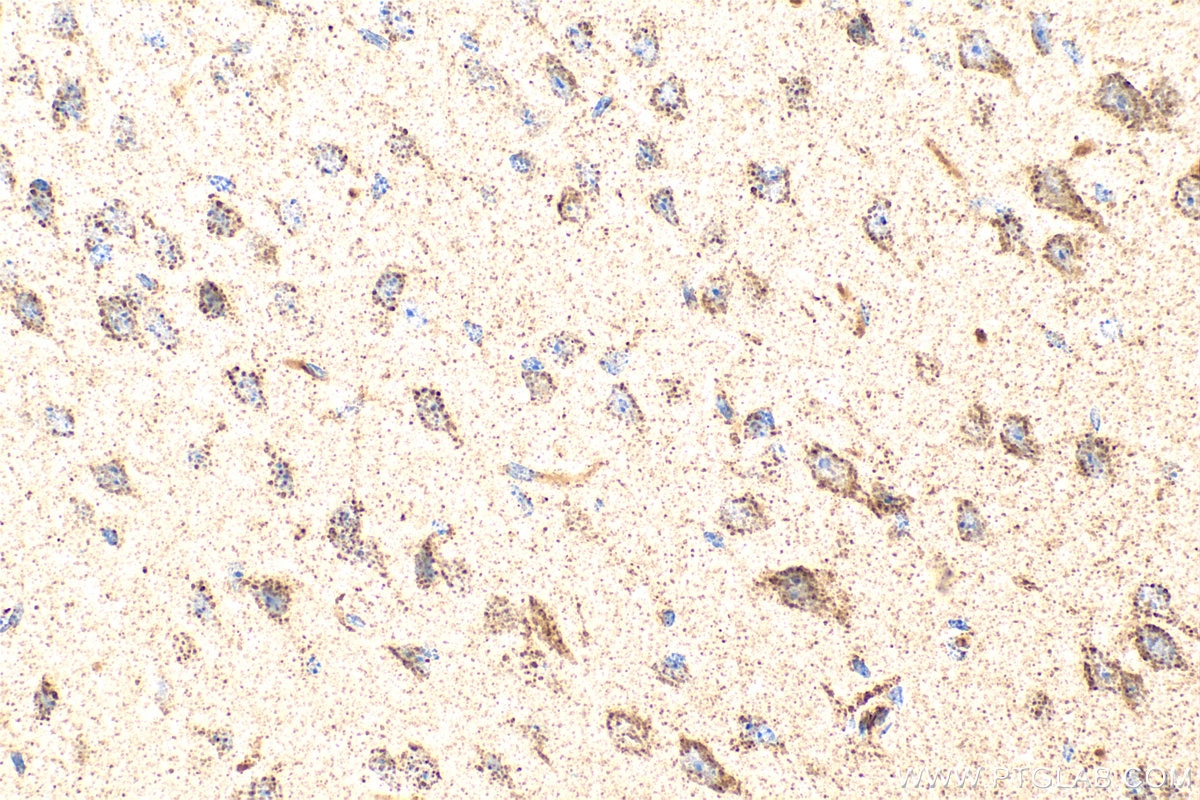 Immunohistochemistry (IHC) staining of mouse brain tissue using FGFR1 Polyclonal antibody (30358-1-AP)
