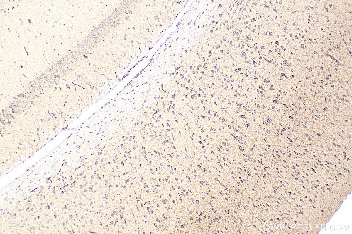 Immunohistochemistry (IHC) staining of mouse brain tissue using FGFR1 Polyclonal antibody (30358-1-AP)