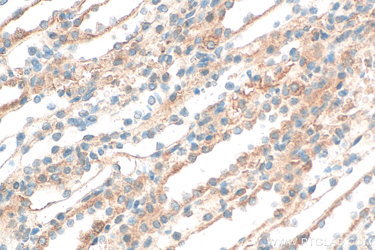 Immunohistochemistry (IHC) staining of rat kidney tissue using FGFR1 Polyclonal antibody (30358-1-AP)