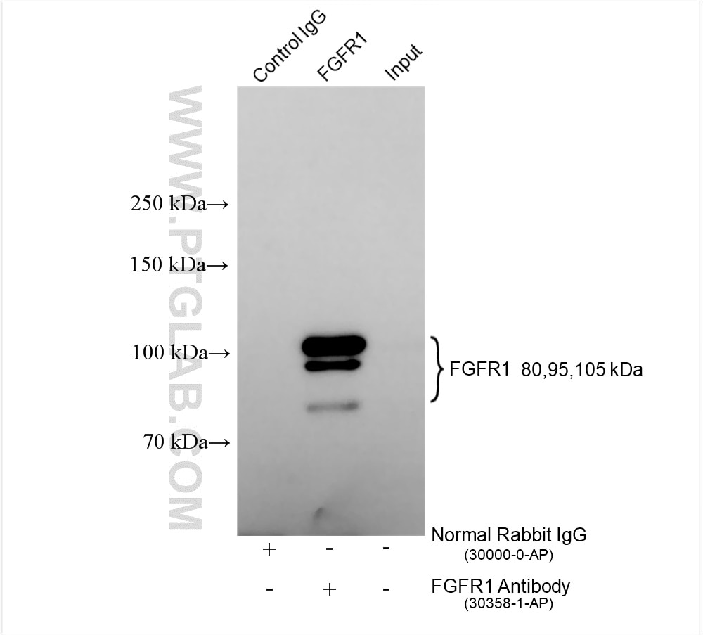 Immunoprecipitation (IP) experiment of SH-SY5Y cells using FGFR1 Polyclonal antibody (30358-1-AP)