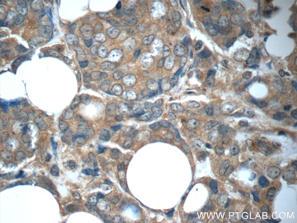 FGFR1 Monoclonal antibody