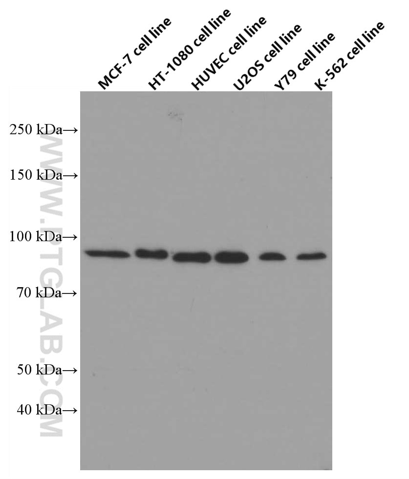 Western Blot (WB) analysis of MCF-7 cells using FGFR1 Monoclonal antibody (60325-1-Ig)