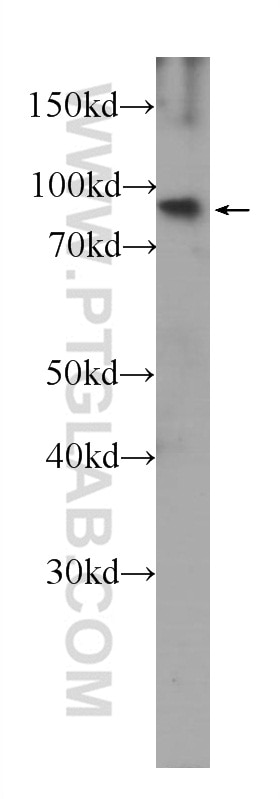 FGFR1 Monoclonal antibody