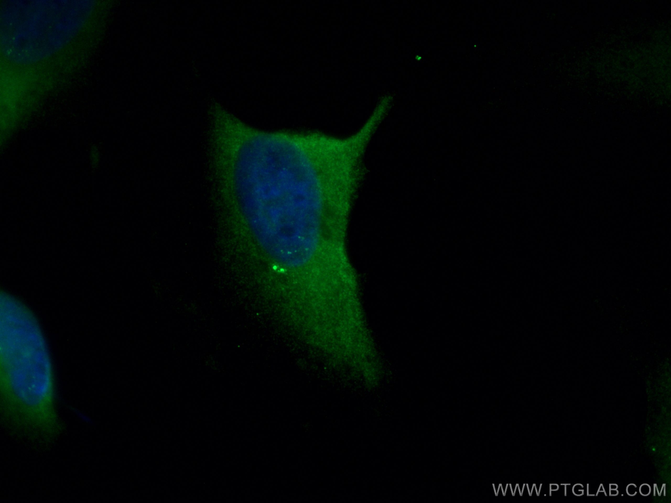 Immunofluorescence (IF) / fluorescent staining of HeLa cells using FGFR1OP Polyclonal antibody (11343-1-AP)