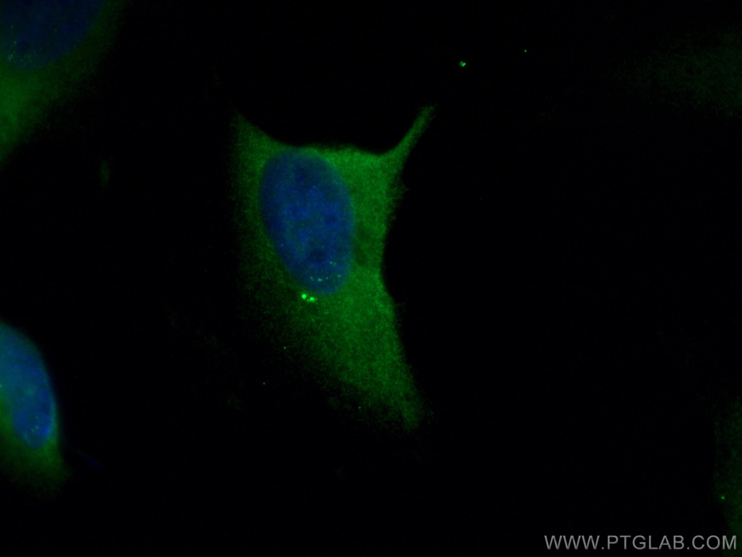 IF Staining of HeLa using 11343-1-AP