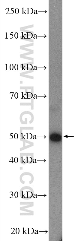 Western Blot (WB) analysis of HEK-293 cells using FGFR1OP Polyclonal antibody (11343-1-AP)