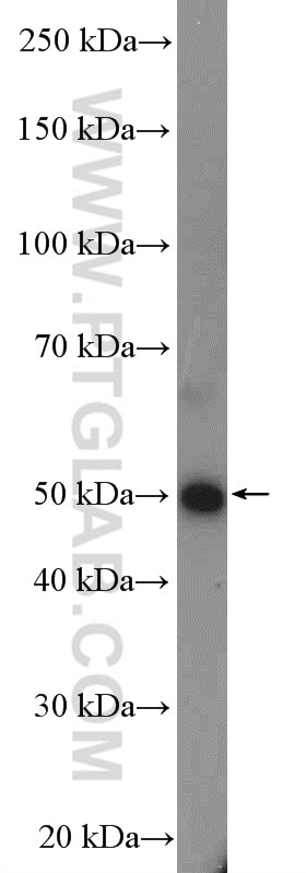 WB analysis of HEK-293 using 11343-1-AP