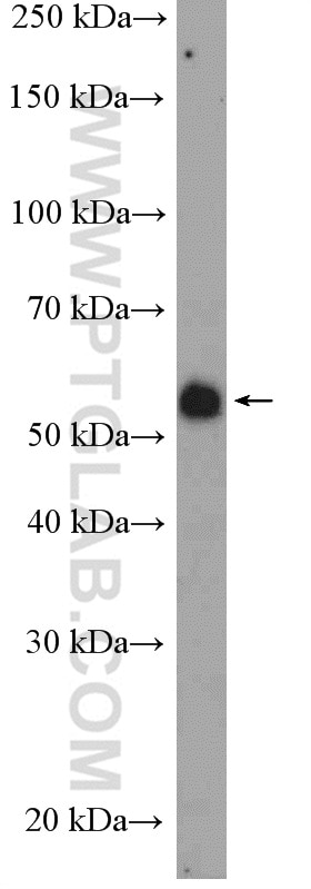 Western Blot (WB) analysis of U-937 cells using FGFR1OP Polyclonal antibody (11343-1-AP)