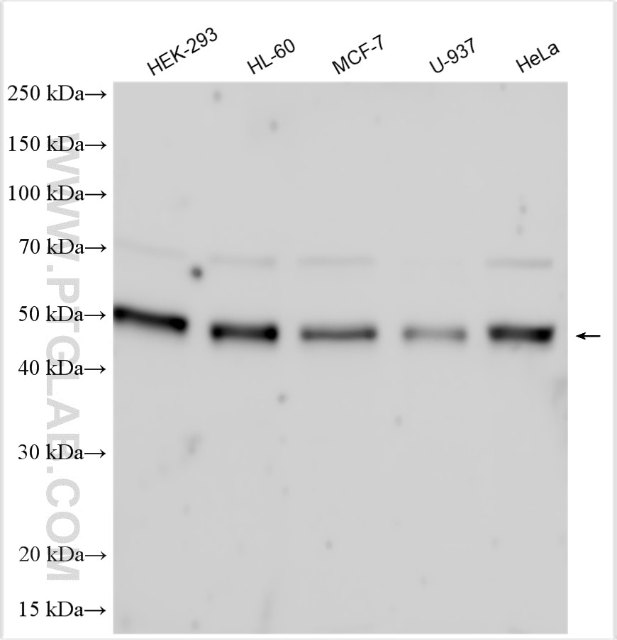 Western Blot (WB) analysis of various lysates using FGFR1OP Polyclonal antibody (11343-1-AP)