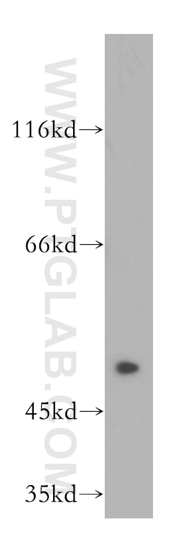 Western Blot (WB) analysis of mouse heart tissue using FGFR1OP Polyclonal antibody (11343-1-AP)