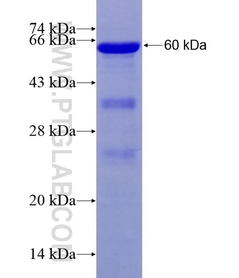 FGFR1OP fusion protein Ag28671 SDS-PAGE