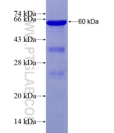 FGFR1OP fusion protein Ag28671 SDS-PAGE