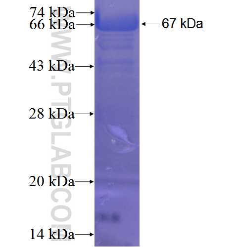 FGFR1OP fusion protein Ag1891 SDS-PAGE