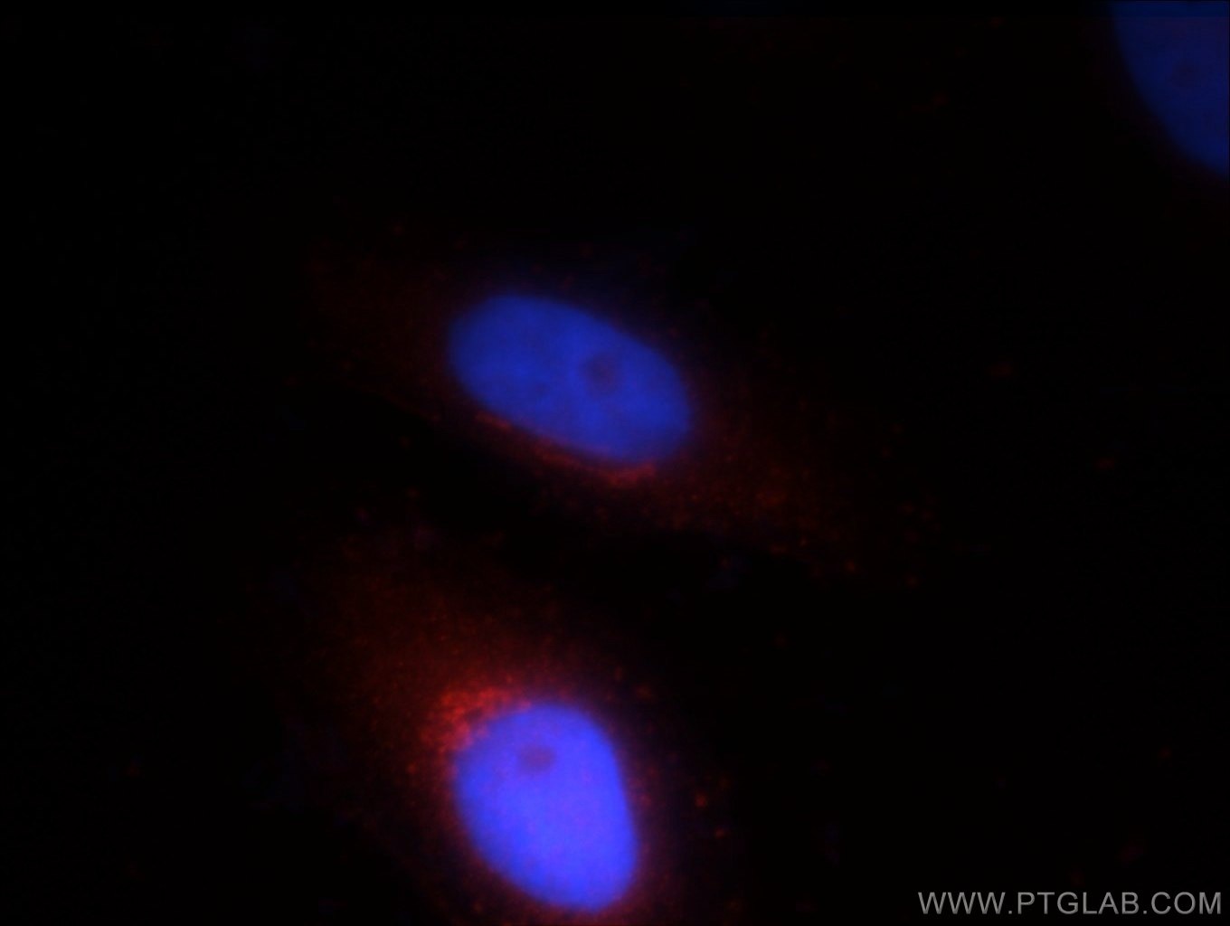 Immunofluorescence (IF) / fluorescent staining of HepG2 cells using FGFR2 Polyclonal antibody (13042-1-AP)
