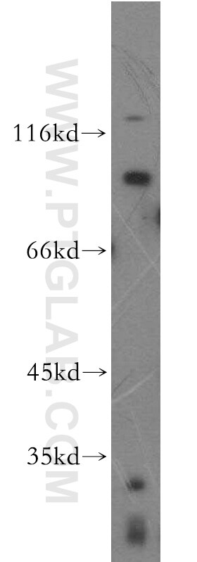 FGFR2 Polyclonal antibody