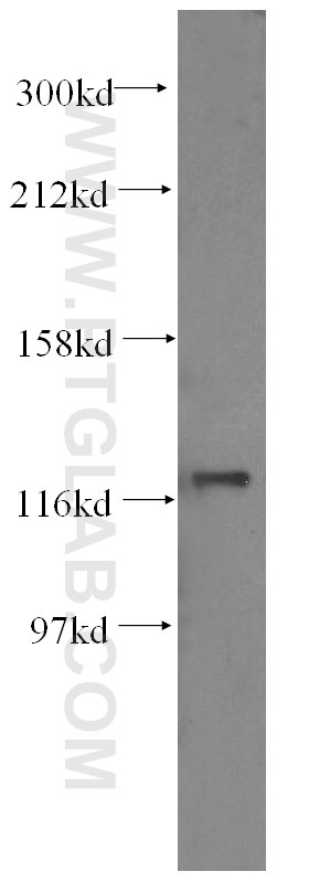 Western Blot (WB) analysis of MCF-7 cells using FGFR2 Monoclonal antibody (60106-1-Ig)