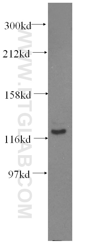 Western Blot (WB) analysis of Jurkat cells using FGFR2 Monoclonal antibody (60106-1-Ig)