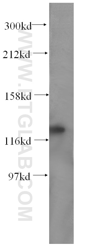 Western Blot (WB) analysis of COLO 320 cells using FGFR2 Monoclonal antibody (60106-1-Ig)