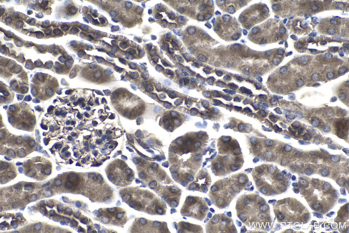 Immunohistochemistry (IHC) staining of mouse kidney tissue using FGFR3 Polyclonal antibody (55358-1-AP)