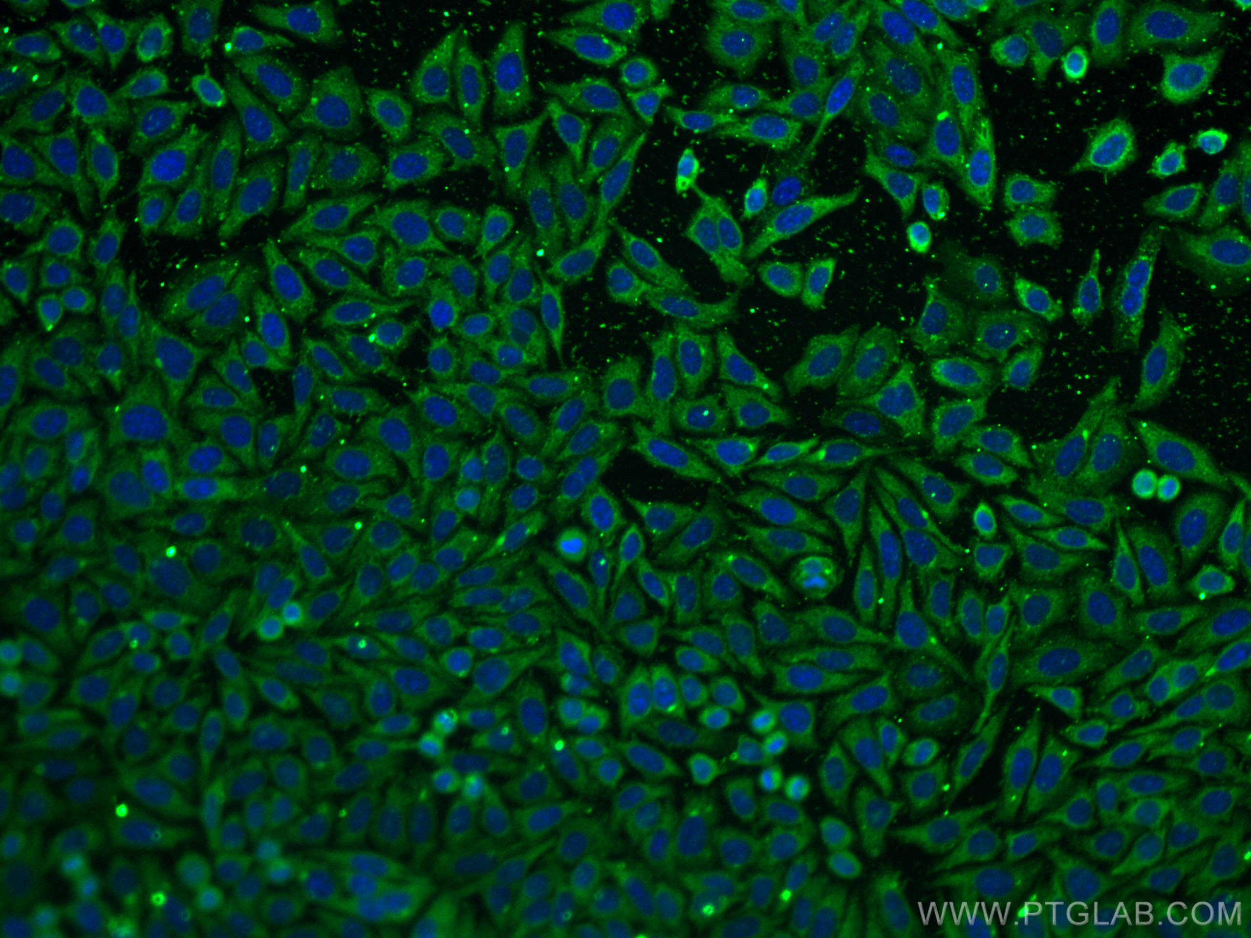 Immunofluorescence (IF) / fluorescent staining of HepG2 cells using FGFR3 Monoclonal antibody (66954-1-Ig)