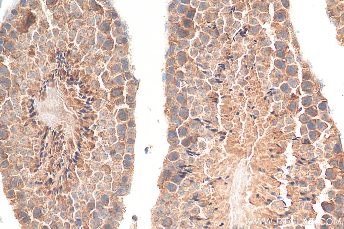 Immunohistochemistry (IHC) staining of mouse testis tissue using FGFR3 Monoclonal antibody (66954-1-Ig)
