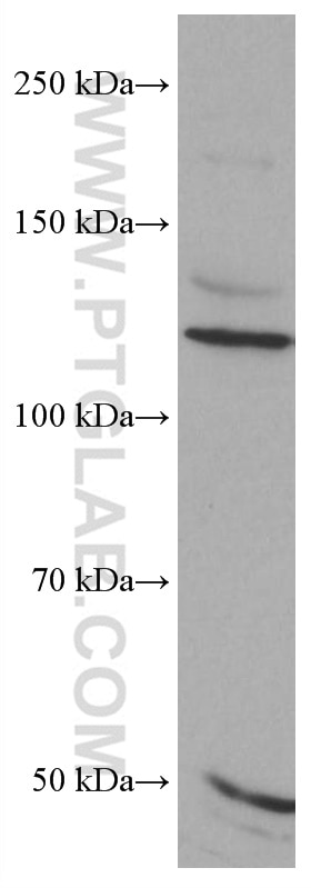 Western Blot (WB) analysis of HeLa cells using FGFR3 Monoclonal antibody (66954-1-Ig)