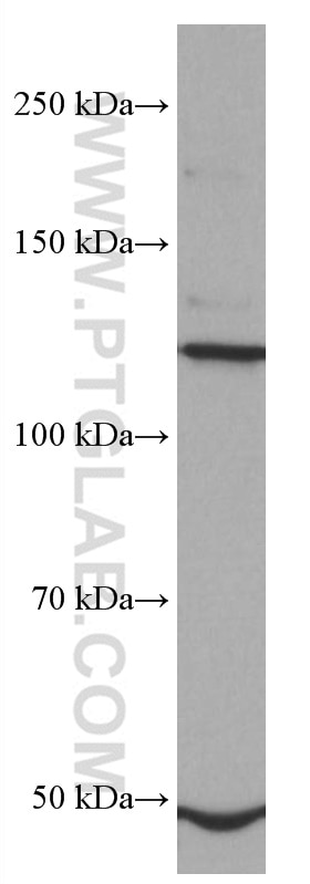 Western Blot (WB) analysis of HEK-293 cells using FGFR3 Monoclonal antibody (66954-1-Ig)