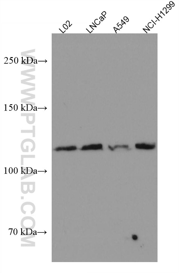 Western Blot (WB) analysis of various lysates using FGFR3 Monoclonal antibody (66954-1-Ig)