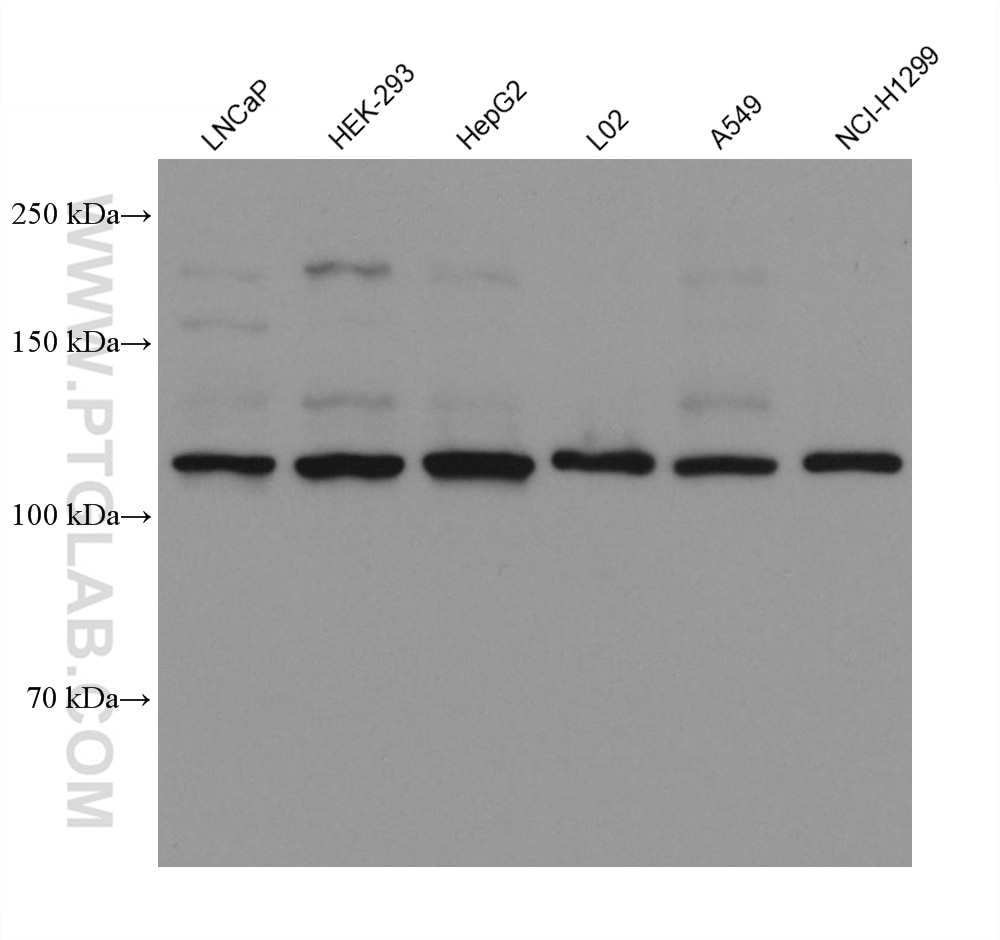 Western Blot (WB) analysis of various lysates using FGFR3 Monoclonal antibody (66954-1-Ig)